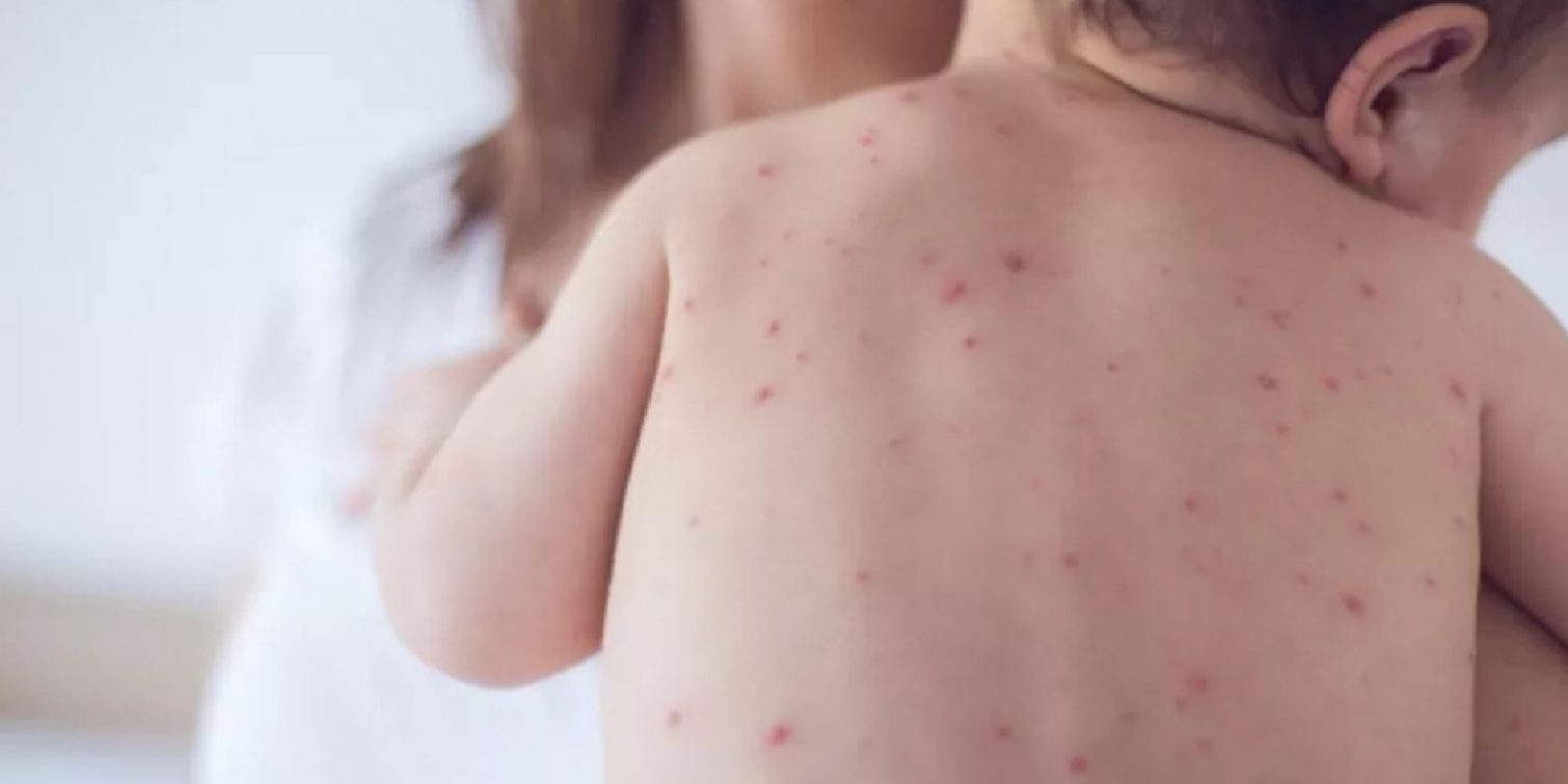 الصحة أوروبا